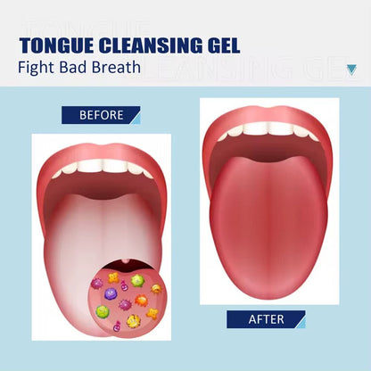 Gel + gratte langue