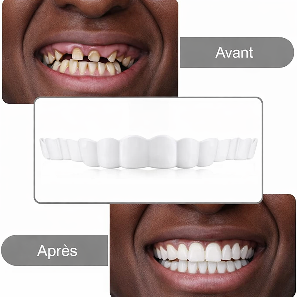 Prothèses dentaires un nouveau sourire